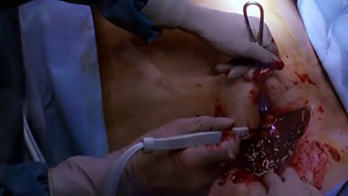 Nip Tuck S01 E03