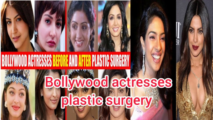 top bollywood actresses plastic surgery 2023 , bollywood surgery fails, Urdu stories with khan