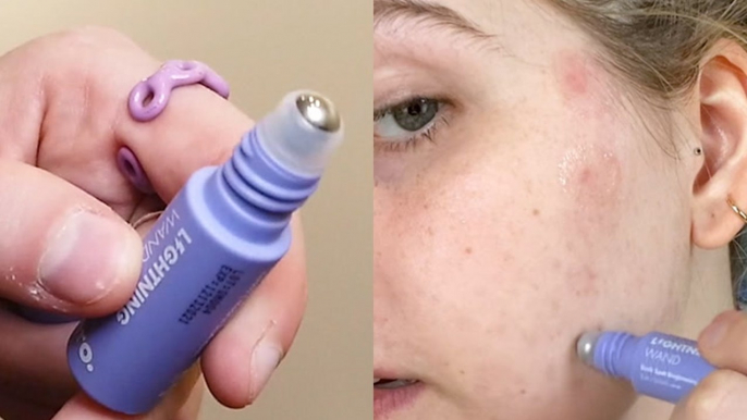 $10 serum wand claims to lighten acne scars