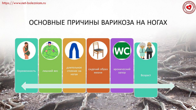 Варикозное расширение вен: 11 методов лечения, причины, симптомы, профилактика и питание