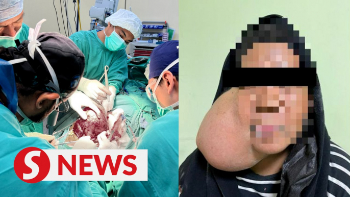 Lahad Datu hospital removes 1.03kg growth from woman's face