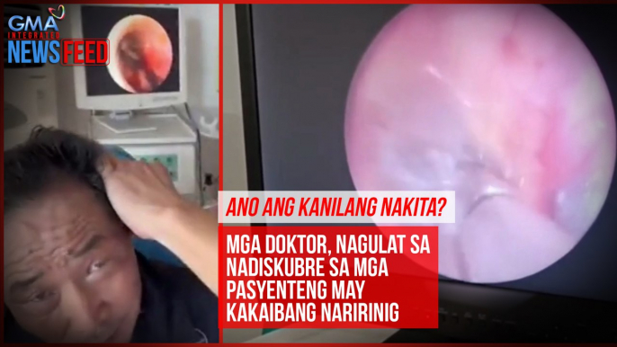 Ano ang kanilang nakita? Mga doktor, nagulat sa nadiskubre sa mga pasyenteng may kakaibang naririnig | GMA Integrated Newsfeed