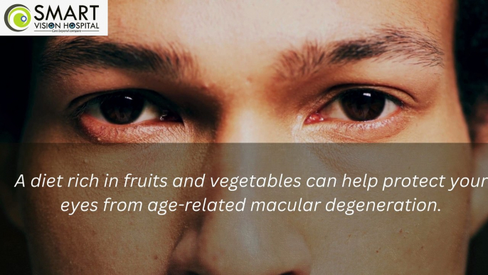 Diet Rich Fruits And Vegetable Can Help Your to Protect Your Eyes