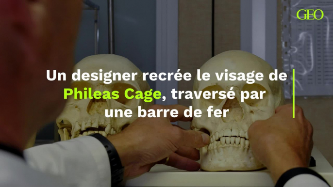 Un designer recrée le visage de Phileas Cage, traversé par une barre de fer