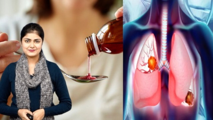 Cough Syrup Side Effects In Hindi: कफ सिरफ पीने के नुकसान | Boldsky