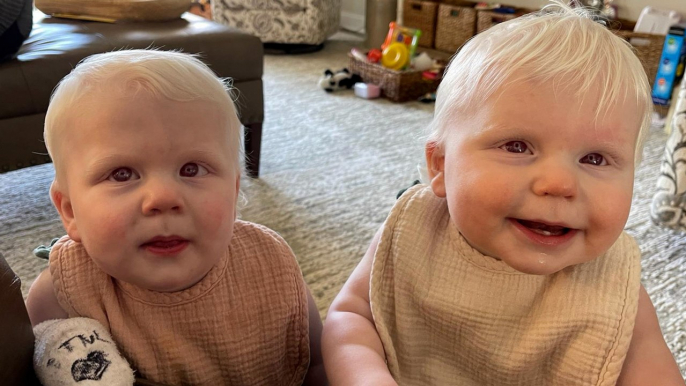 "My twin daughters were born with albinism"