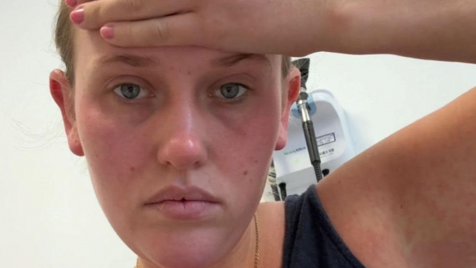 Brit tourist on dream trip to Bali mistook deadly dengue fever for the flu