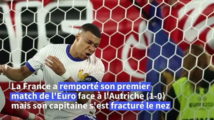 Euro de football: les Bleus inquiets après la fracture du nez de Mbappé