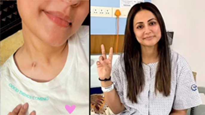 Hina Khan Shows Chemotherapy Marks After Surgery Latest Health Update Post Viral, 'Good...| Boldsky