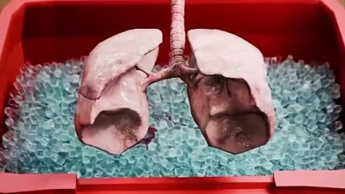 How Donor Lungs Are Kept Fresh